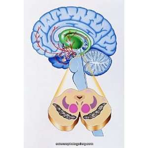  Artwork of brain areas in Parkinsons disease Framed Prints 